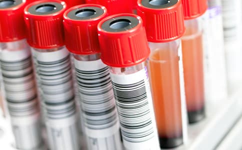 RFID電子標簽閱讀器與天線用于智能試劑柜和生物樣本柜管理方案